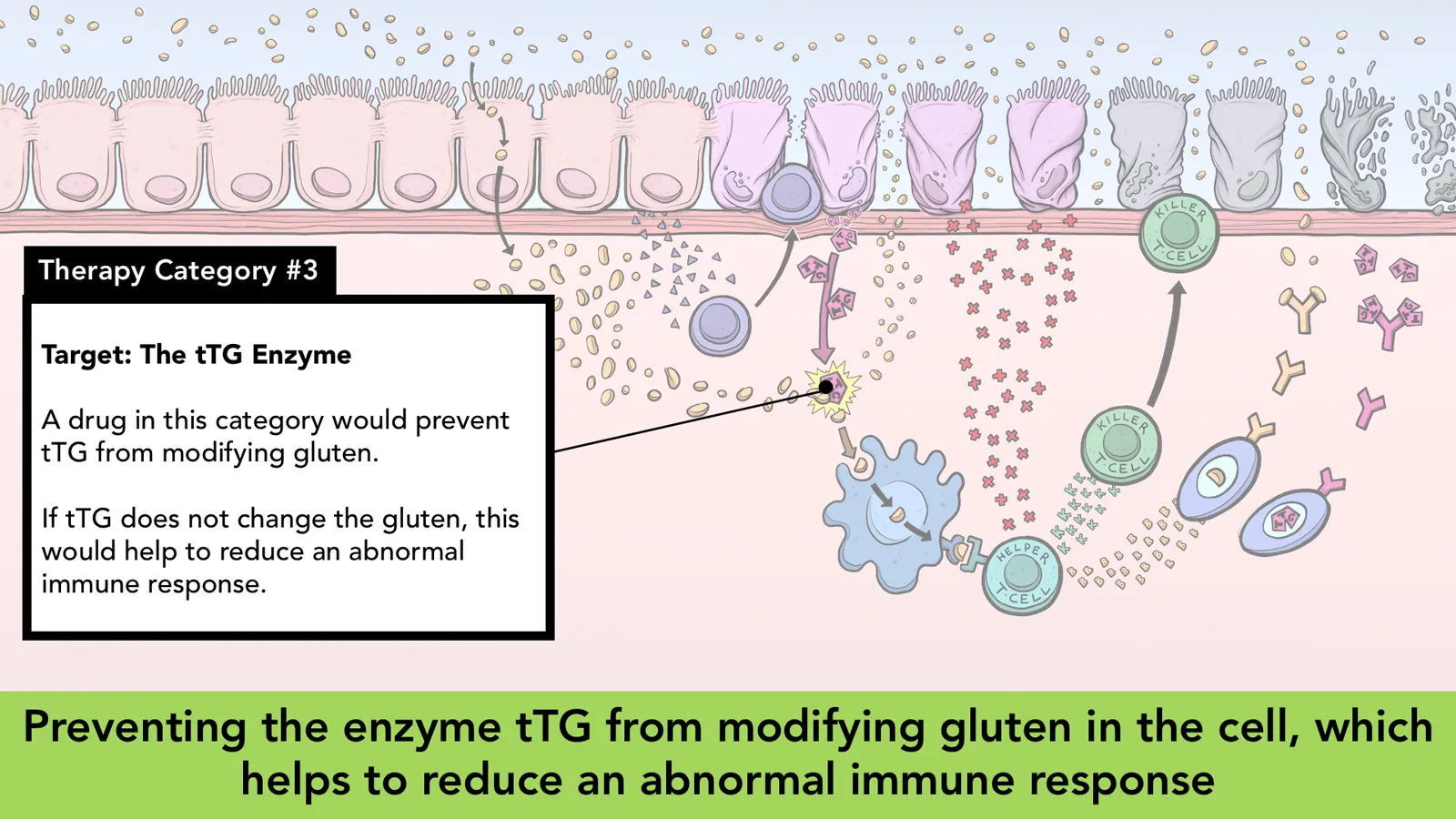 Gut Reaction - Celiac Disease hero