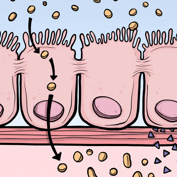 Gut Reaction - Celiac Disease hero
