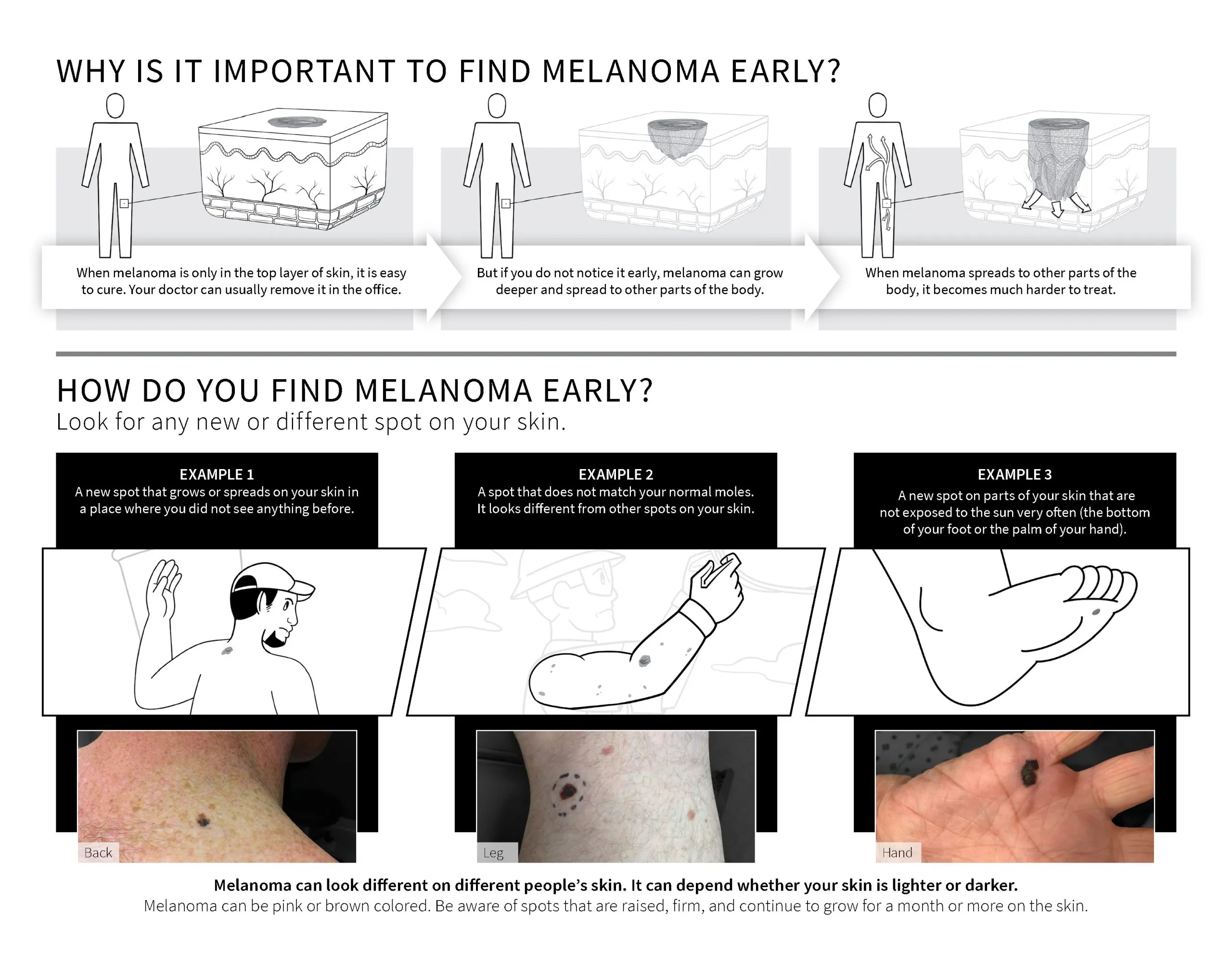 Skin Cancer in California hero